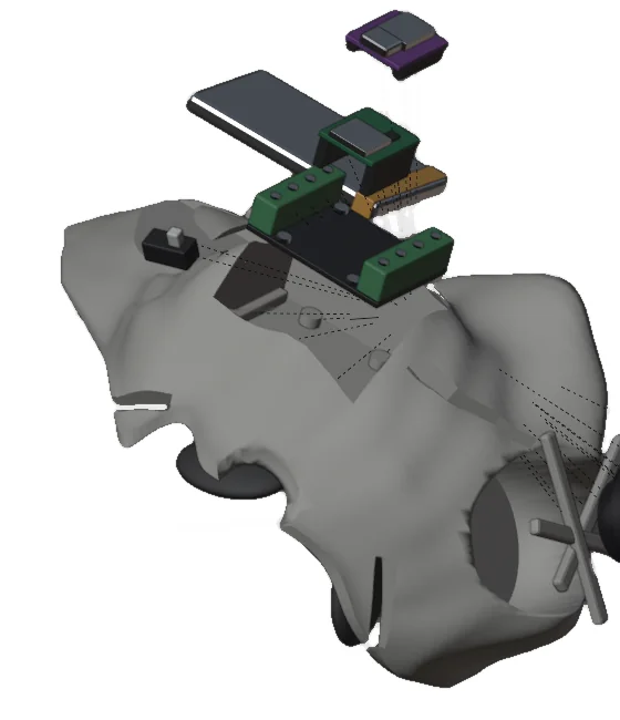 Exploded digital view showing the earlier shell and electronic component proxies.